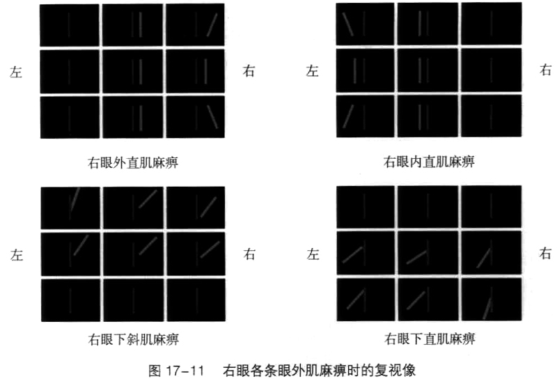 复视像检查图片